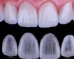 CARRILLA DENTALES