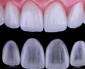 CARRILLA DENTALES