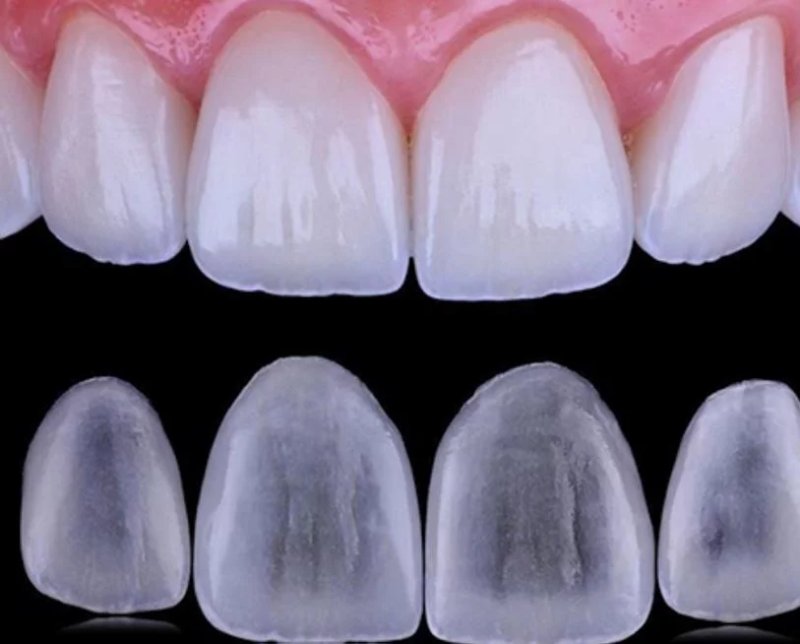 CARRILLA DENTALES