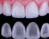 CARRILLA DENTALES